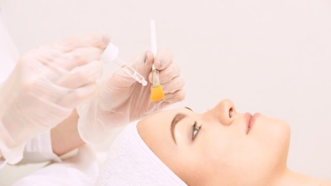 Aging Skin but Not Ready for Needles? Try a Chemical Peel