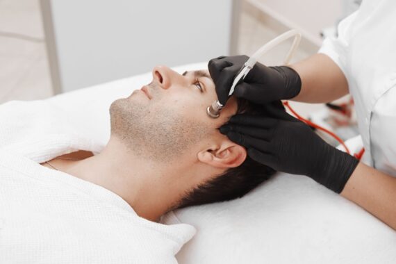 Why Microdermabrasion Is So Popular and How It Can Help You