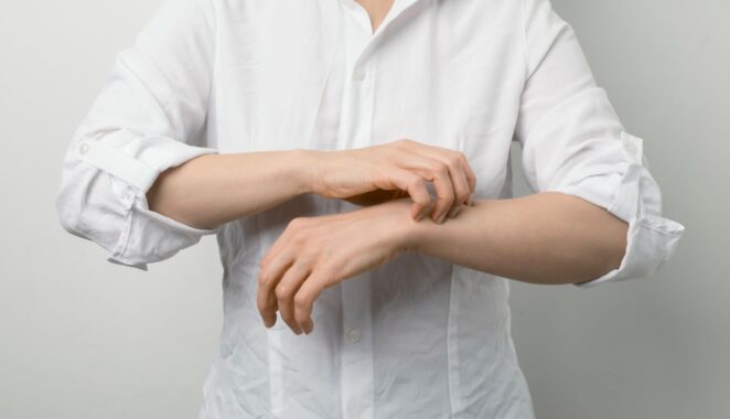 What Do I Ask My Dermatologist About Eczema?