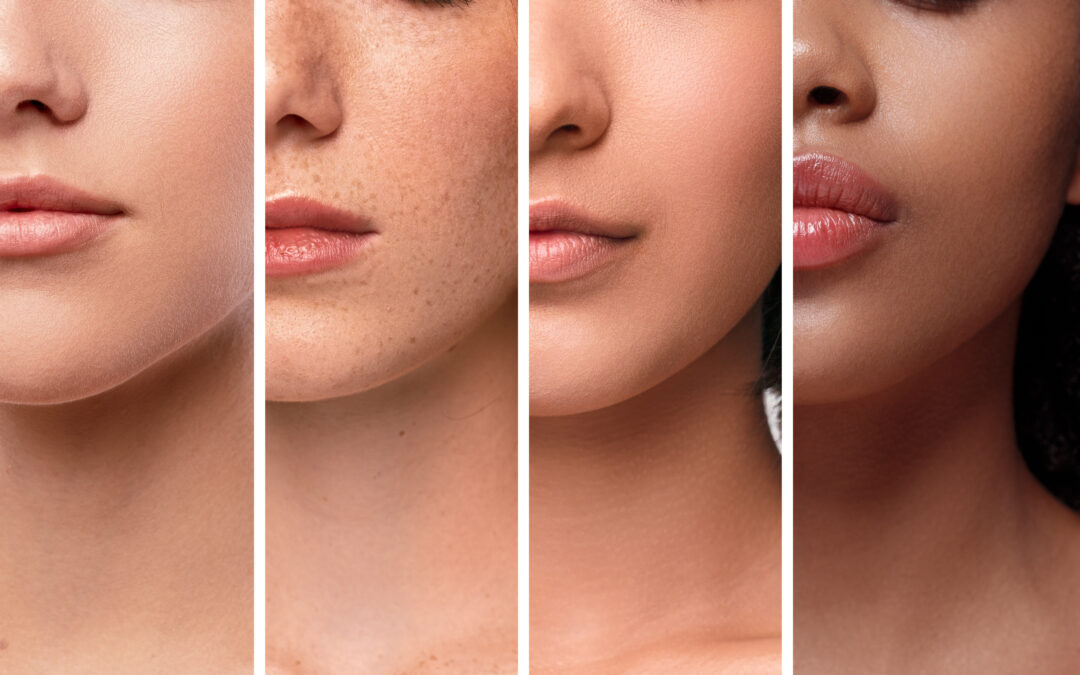 Understanding Fitzpatrick Skin Types: A Guide to Personalized Skin Care